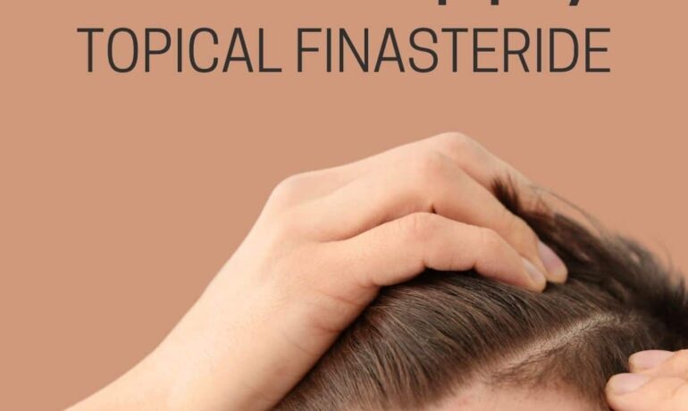 How To Apply Topical Finasteride