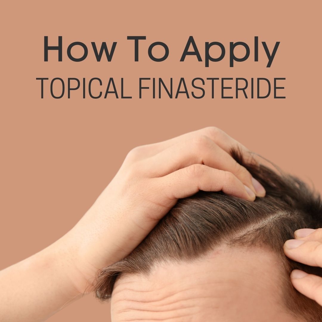 how to apply topical finasteride featured image