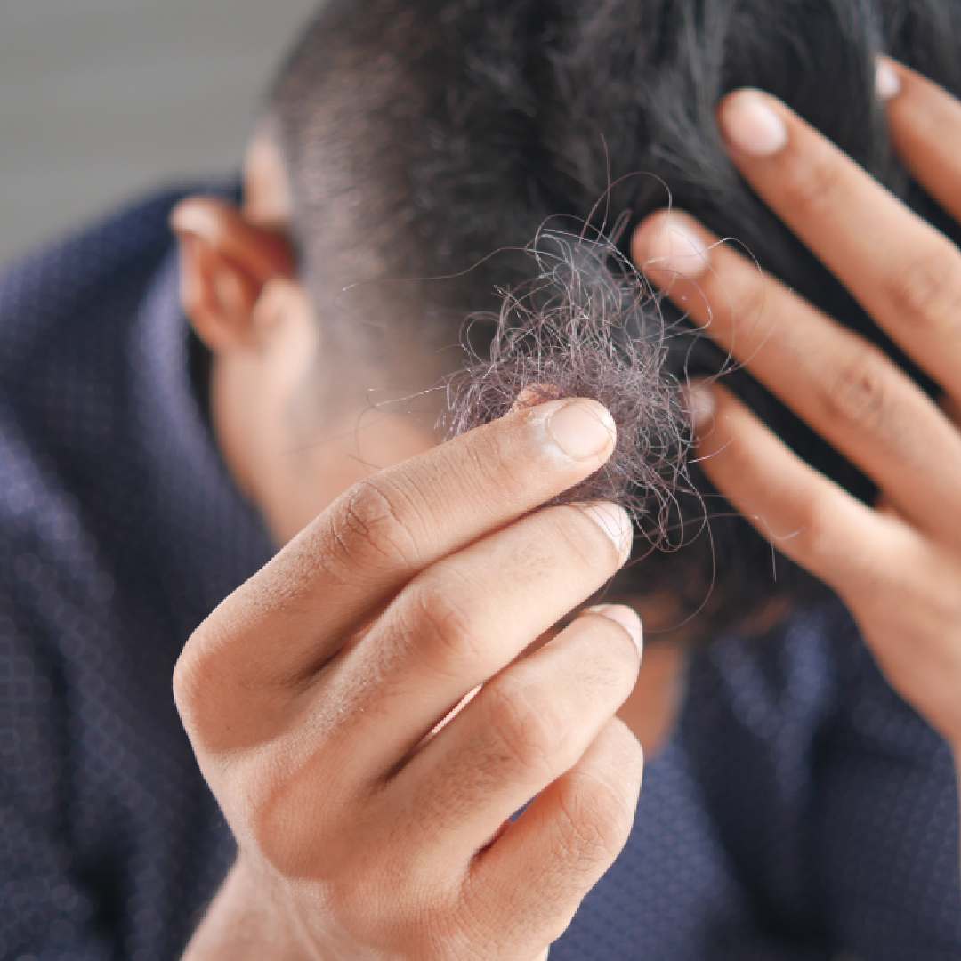 man shedding hair looking at hair he pulls out of his comb