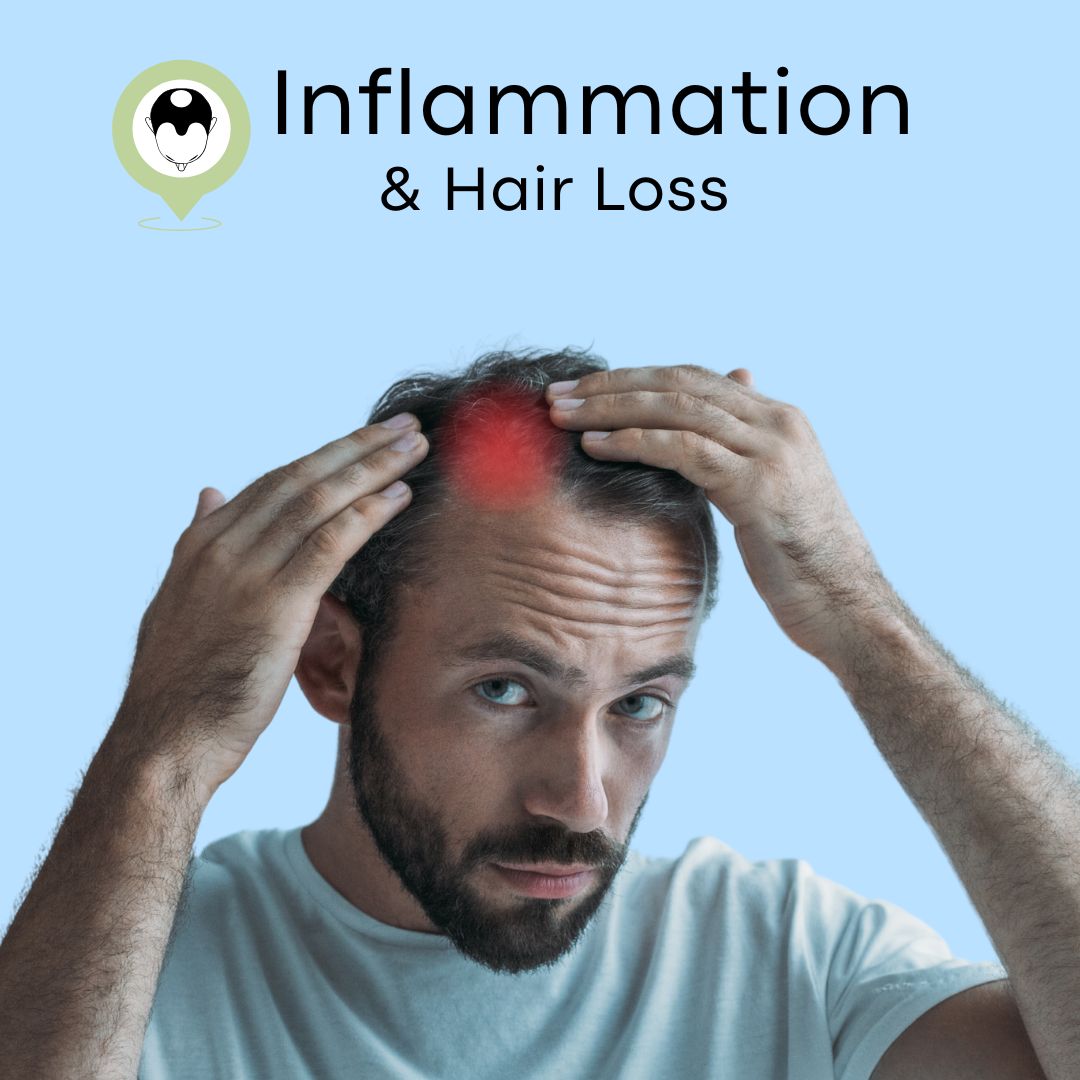 inflammation and hair loss main on temple