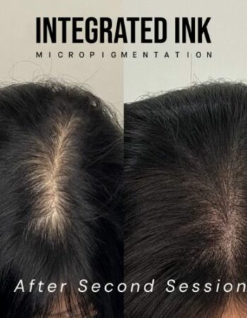 Integrated Ink Micropigmentation