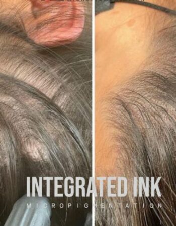 Integrated Ink Micropigmentation